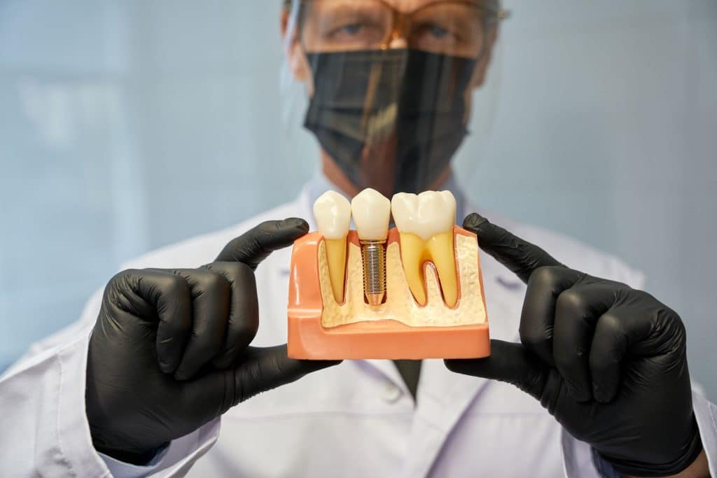 implant tedavisi
