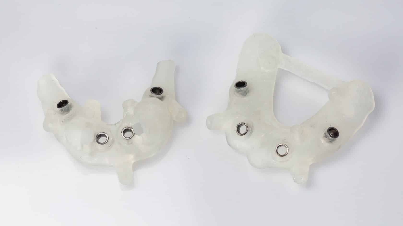 All on Four implant