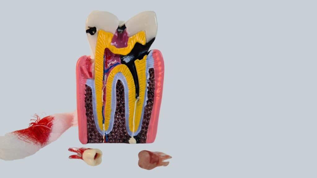 endodonti tedavisi