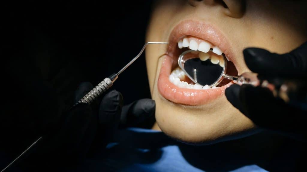 endodonti tedavisi