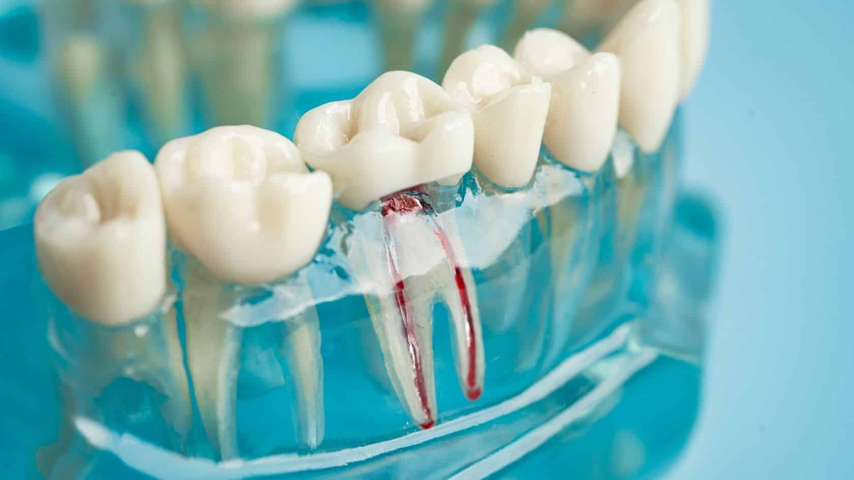 endodonti bölümü