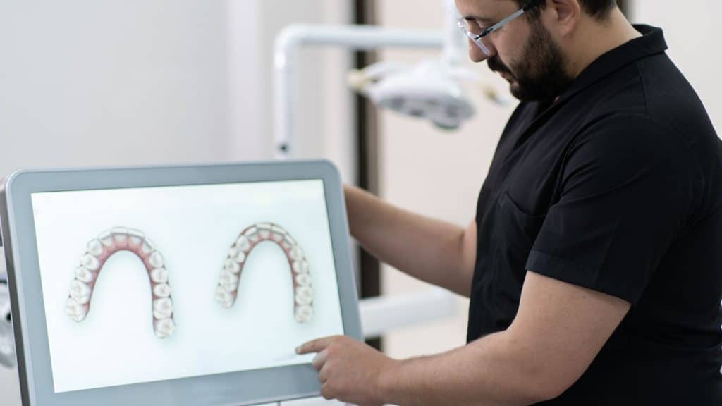 invisalign tedavisinde 3 boyutlu çene modelleme